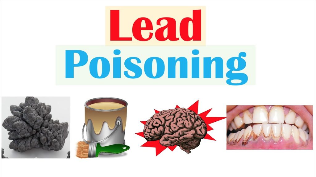 Lead poisoning